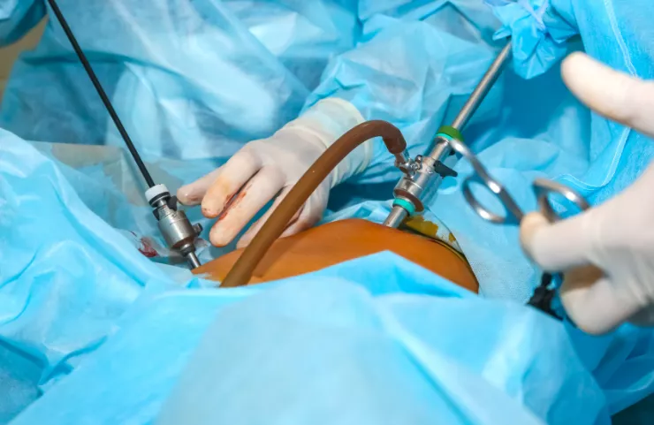 Minimally Invasive Spine Endoscopy Near Me In Mira Road